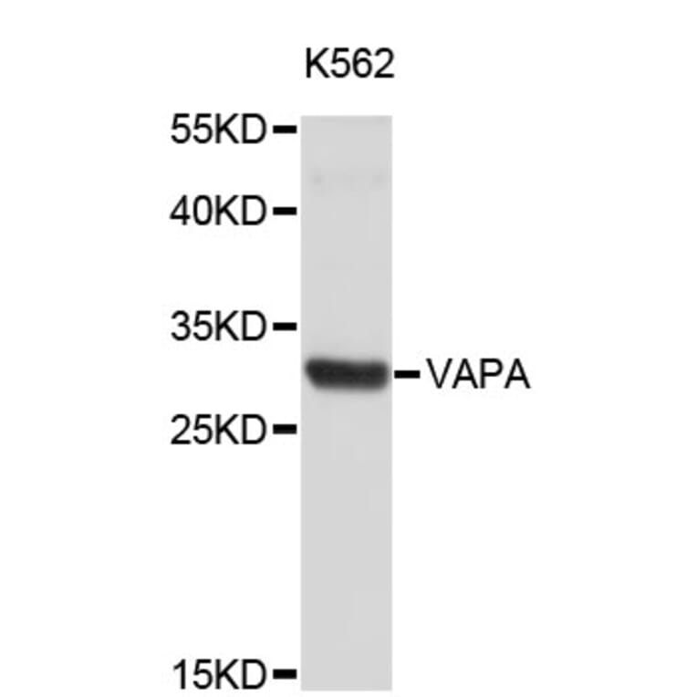 Western Blot - Anti-VAPA Antibody (A4279) - Antibodies.com
