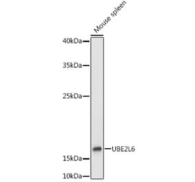Western Blot - Anti-Ube2L6 Antibody (A9425) - Antibodies.com