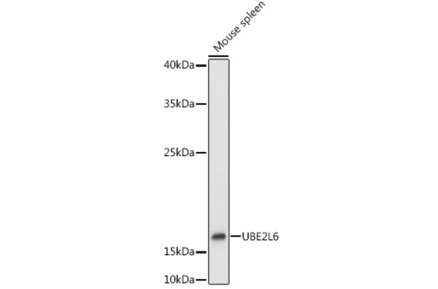 Western Blot - Anti-Ube2L6 Antibody (A9425) - Antibodies.com