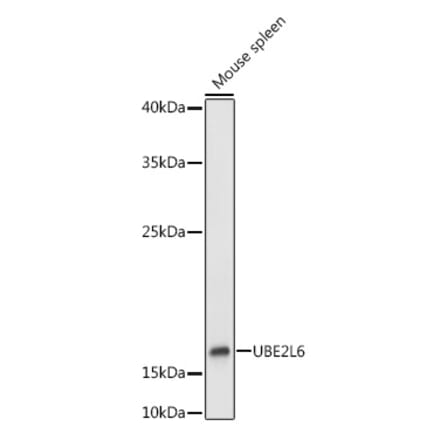 Western Blot - Anti-Ube2L6 Antibody (A9425) - Antibodies.com