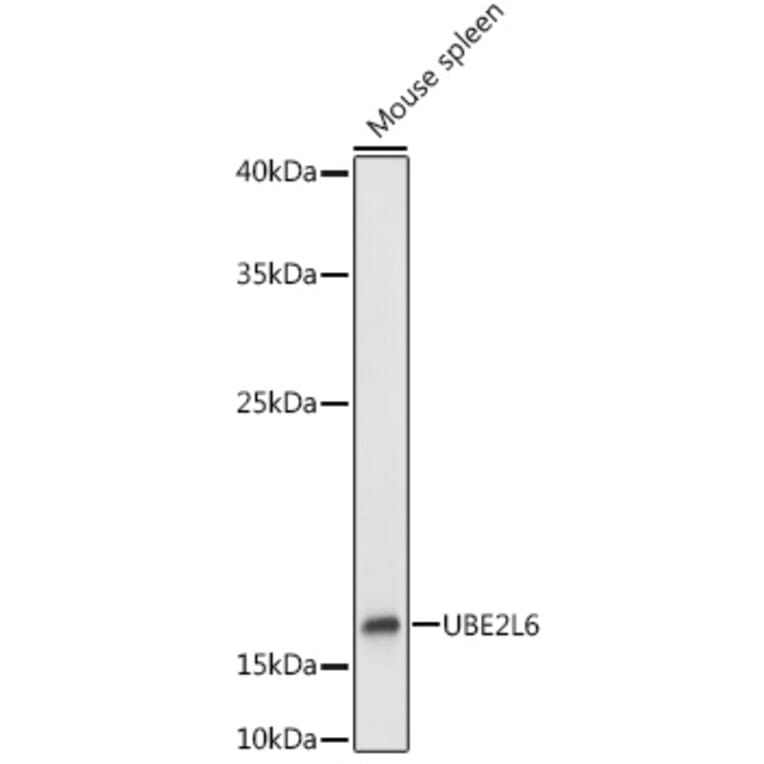 Western Blot - Anti-Ube2L6 Antibody (A9425) - Antibodies.com