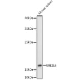 Western Blot - Anti-Ube2L6 Antibody (A9425) - Antibodies.com