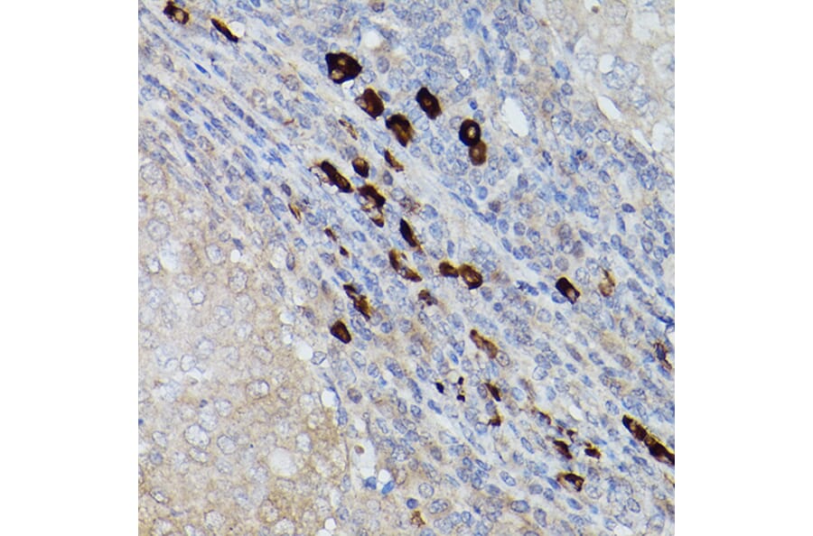 Immunohistochemistry - Anti-Ube2L6 Antibody (A9425) - Antibodies.com