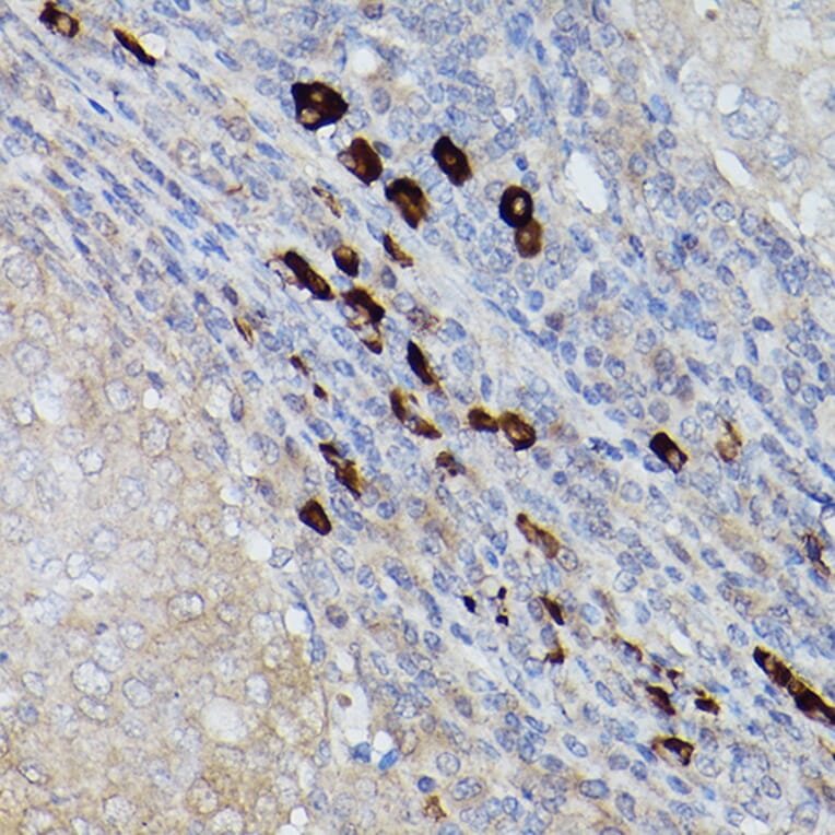 Immunohistochemistry - Anti-Ube2L6 Antibody (A9425) - Antibodies.com