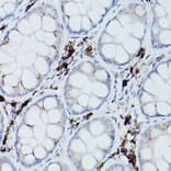 Immunohistochemistry - Anti-Ube2L6 Antibody (A9425) - Antibodies.com