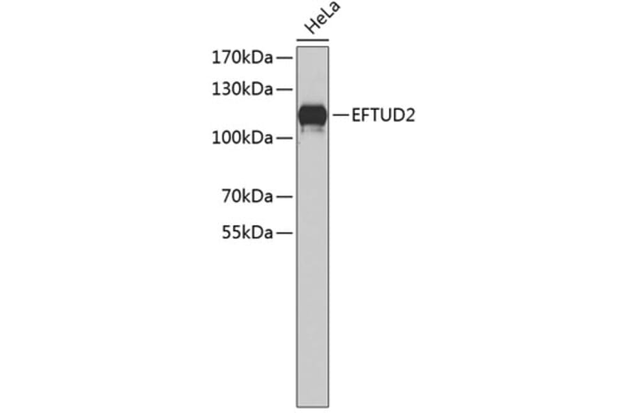 Western Blot - Anti-EFTUD2 Antibody (A4291) - Antibodies.com