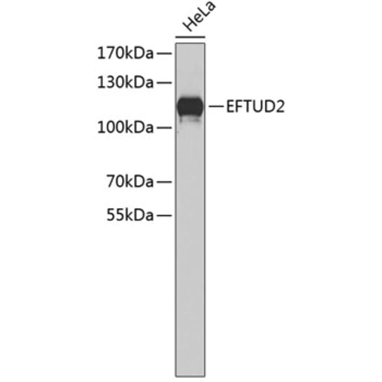 Western Blot - Anti-EFTUD2 Antibody (A4291) - Antibodies.com