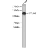 Western Blot - Anti-EFTUD2 Antibody (A4291) - Antibodies.com