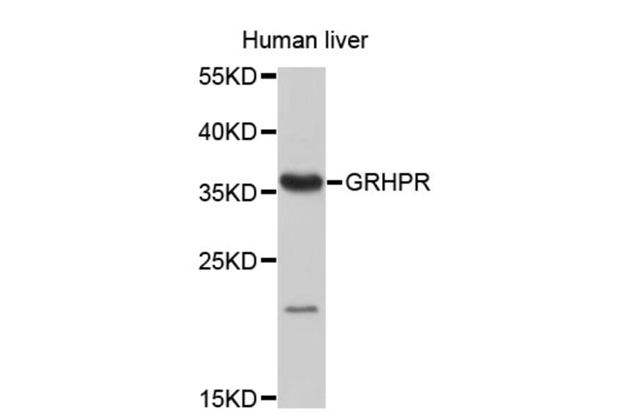 Western Blot - Anti-GRHPR Antibody (A4295) - Antibodies.com