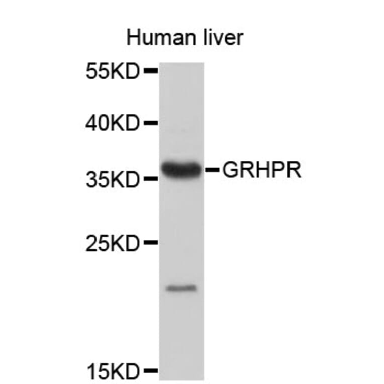 Western Blot - Anti-GRHPR Antibody (A4295) - Antibodies.com