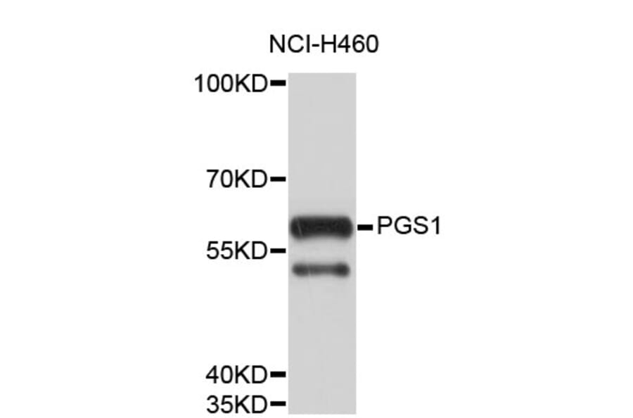 Western Blot - Anti-PGS1 Antibody (A4309) - Antibodies.com