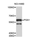 Western Blot - Anti-PGS1 Antibody (A4309) - Antibodies.com