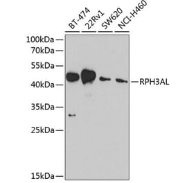 Western Blot - Anti-RPH3AL Antibody (A9432) - Antibodies.com