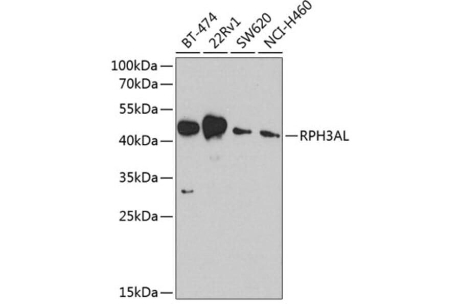 Western Blot - Anti-RPH3AL Antibody (A9432) - Antibodies.com
