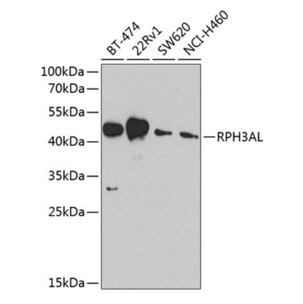 Western Blot - Anti-RPH3AL Antibody (A9432) - Antibodies.com