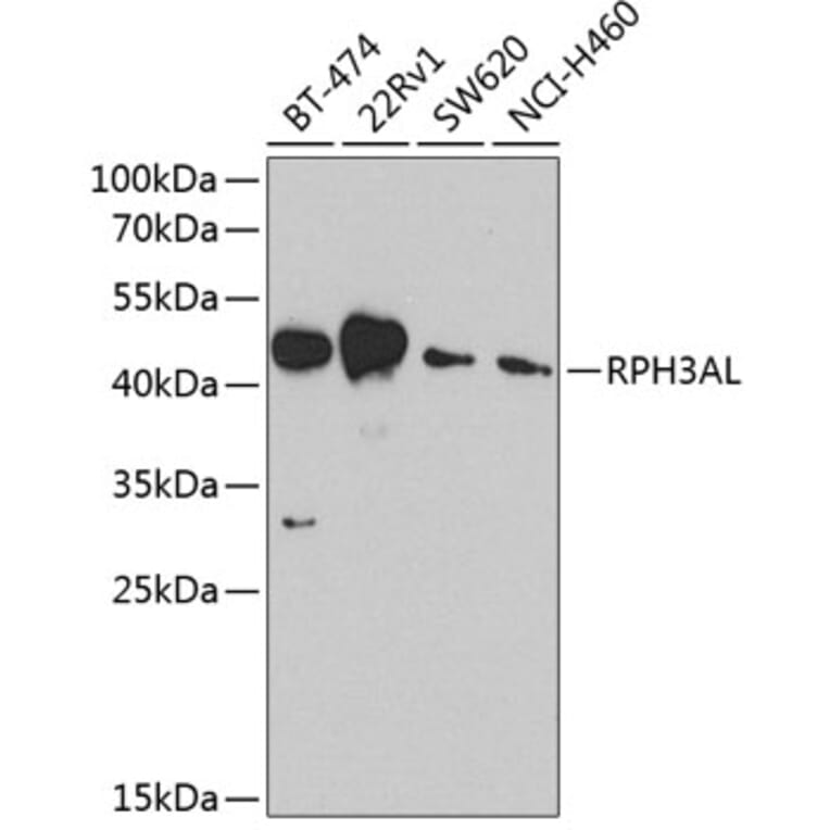 Western Blot - Anti-RPH3AL Antibody (A9432) - Antibodies.com