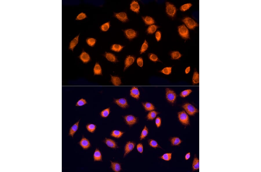 Immunofluorescence - Anti-RPH3AL Antibody (A9432) - Antibodies.com
