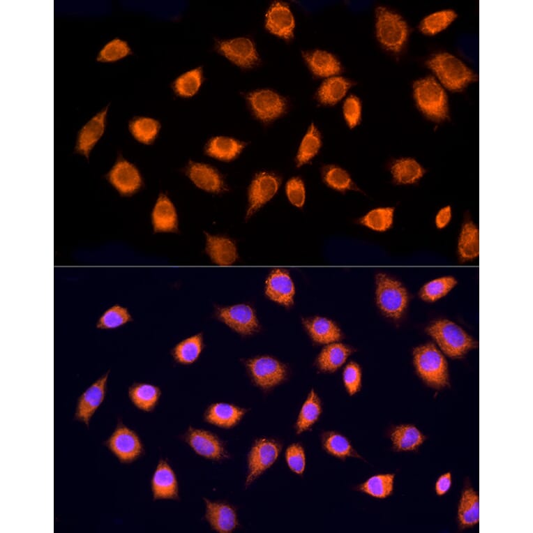 Immunofluorescence - Anti-RPH3AL Antibody (A9432) - Antibodies.com