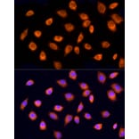 Immunofluorescence - Anti-RPH3AL Antibody (A9432) - Antibodies.com