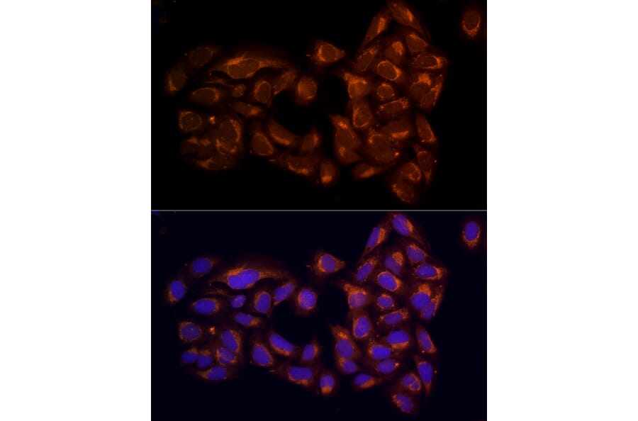 Immunofluorescence - Anti-RPH3AL Antibody (A9432) - Antibodies.com