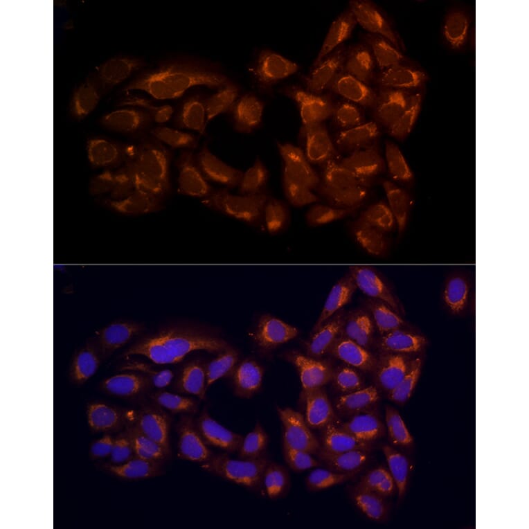 Immunofluorescence - Anti-RPH3AL Antibody (A9432) - Antibodies.com