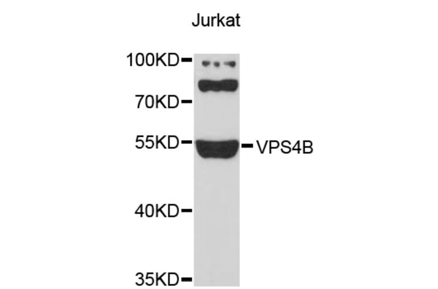 Western Blot - Anti-VPS4B Antibody (A4315) - Antibodies.com