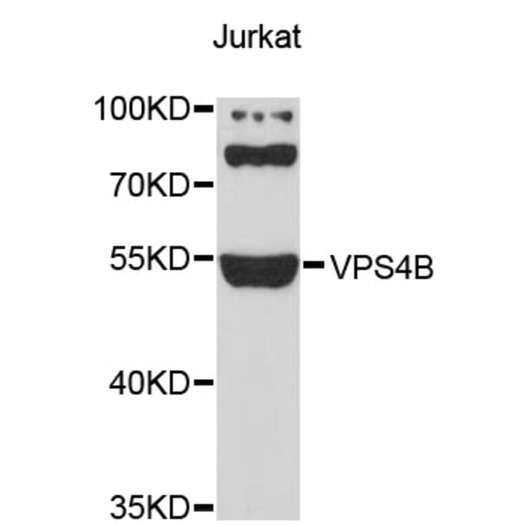 Western Blot - Anti-VPS4B Antibody (A4315) - Antibodies.com
