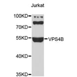 Western Blot - Anti-VPS4B Antibody (A4315) - Antibodies.com