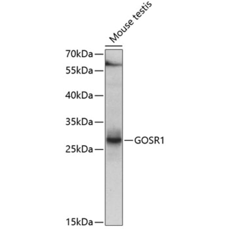 Western Blot - Anti-GOSR1 Antibody (A4316) - Antibodies.com