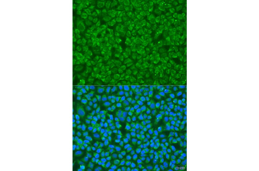 Immunofluorescence - Anti-GOSR1 Antibody (A4316) - Antibodies.com