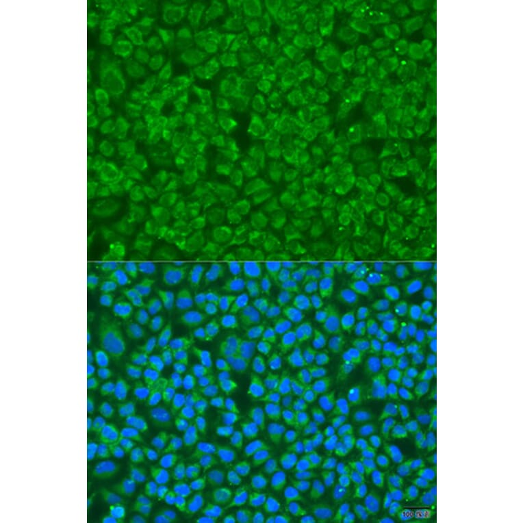 Immunofluorescence - Anti-GOSR1 Antibody (A4316) - Antibodies.com