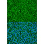 Immunofluorescence - Anti-GOSR1 Antibody (A4316) - Antibodies.com