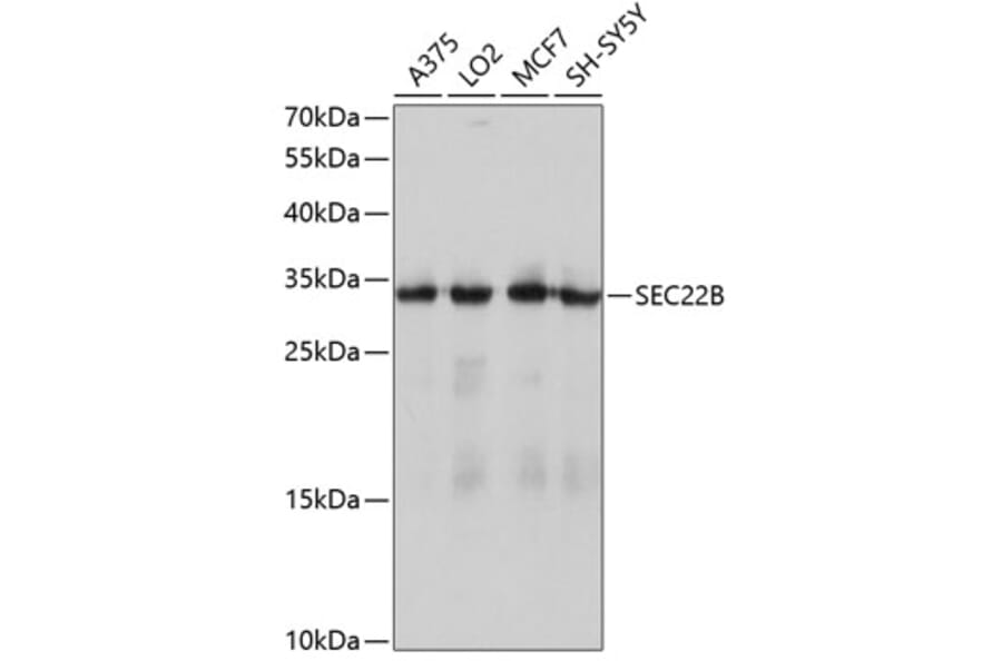 Western Blot - Anti-SEC22B Antibody (A4318) - Antibodies.com
