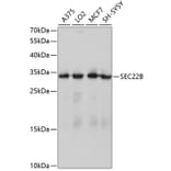 Western Blot - Anti-SEC22B Antibody (A4318) - Antibodies.com