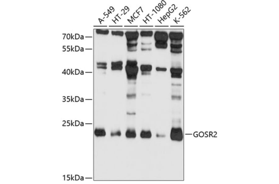 Western Blot - Anti-Membrin Antibody (A9437) - Antibodies.com