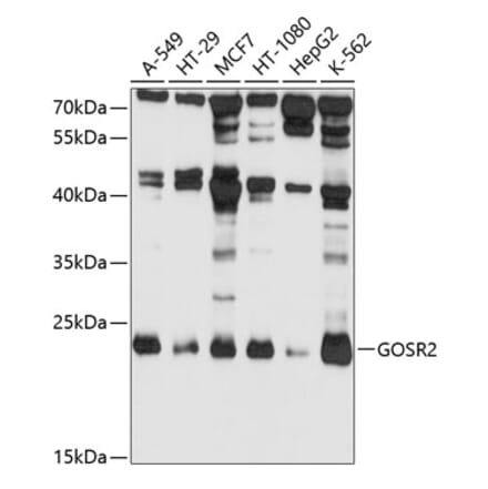 Western Blot - Anti-Membrin Antibody (A9437) - Antibodies.com