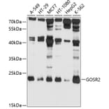 Western Blot - Anti-Membrin Antibody (A9437) - Antibodies.com