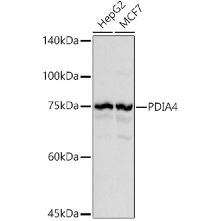 Western Blot - Anti-ERp72 Antibody (A9438) - Antibodies.com