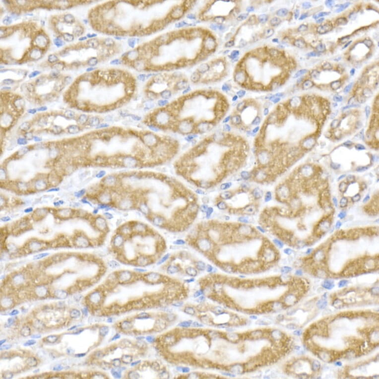 Immunohistochemistry - Anti-ERp72 Antibody (A9438) - Antibodies.com