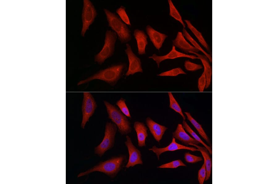 Immunofluorescence - Anti-ERp72 Antibody (A9438) - Antibodies.com