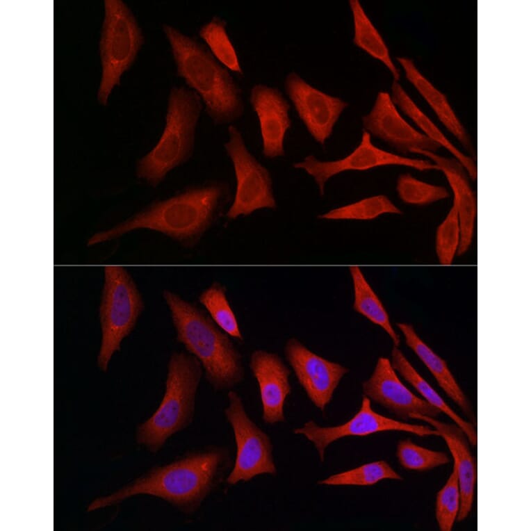 Immunofluorescence - Anti-ERp72 Antibody (A9438) - Antibodies.com