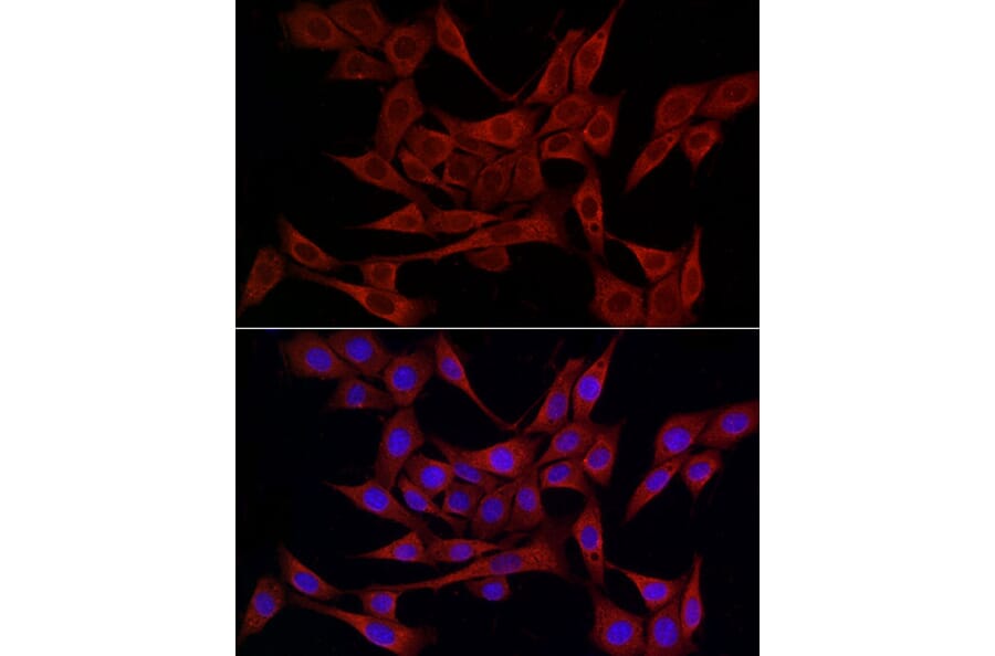 Immunofluorescence - Anti-ERp72 Antibody (A9438) - Antibodies.com
