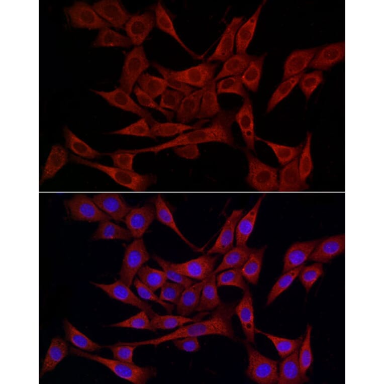 Immunofluorescence - Anti-ERp72 Antibody (A9438) - Antibodies.com