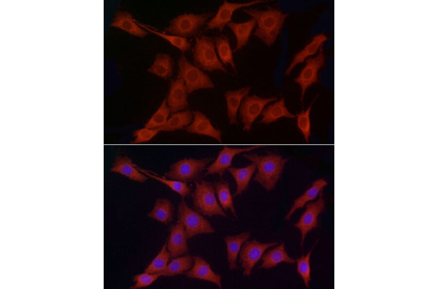 Immunofluorescence - Anti-ERp72 Antibody (A9438) - Antibodies.com