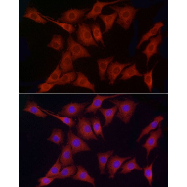 Immunofluorescence - Anti-ERp72 Antibody (A9438) - Antibodies.com