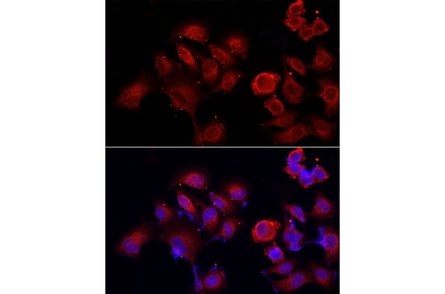 Immunofluorescence - Anti-ERp72 Antibody (A9438) - Antibodies.com