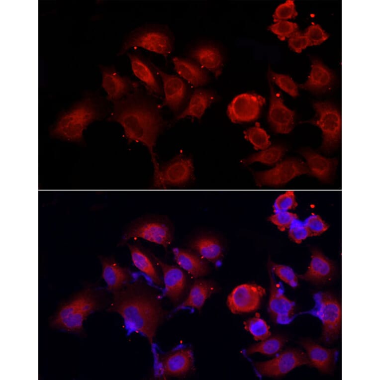 Immunofluorescence - Anti-ERp72 Antibody (A9438) - Antibodies.com