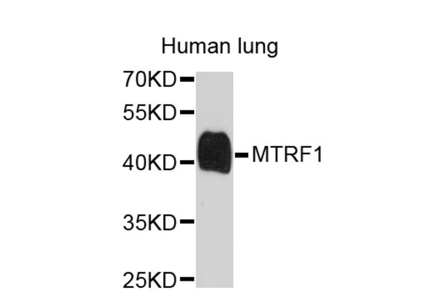 Western Blot - Anti-MTRF1 Antibody (A4327) - Antibodies.com
