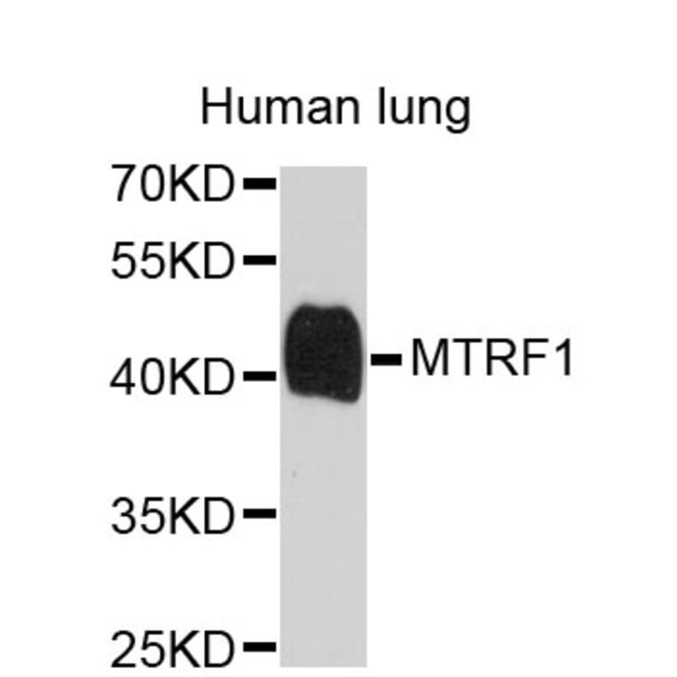 Western Blot - Anti-MTRF1 Antibody (A4327) - Antibodies.com