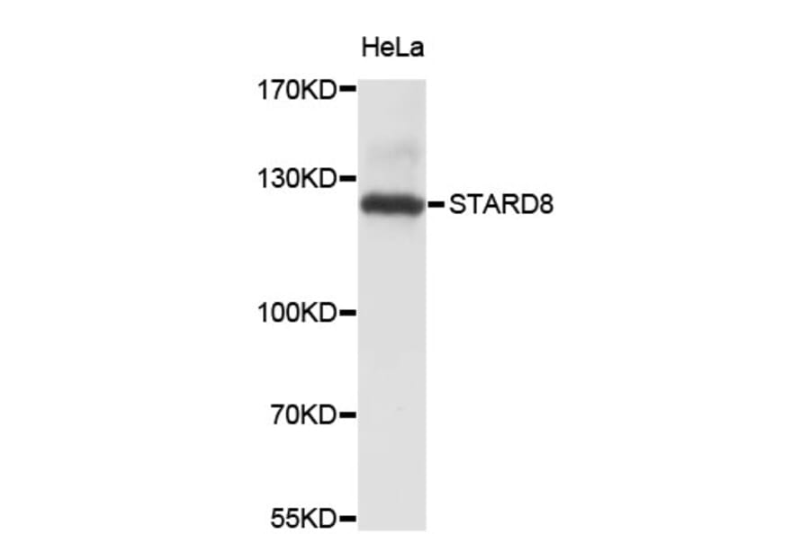 Western Blot - Anti-STARD8 Antibody (A4336) - Antibodies.com